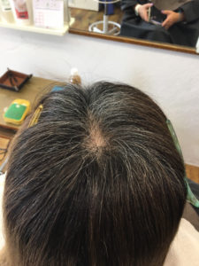 奈良県奈良市|若白髪、グレーカラー、30代 40代 若白髪染め、カラーリングが得意なサロン、美容院、美容室、奈良県奈良市でヘッドスパが進化したアーユルヴェーダ とリンパマッサージ得意なサロン、美容院、美容室、奈良県奈良市で白髪染め、ヘナカラー得意なサロン、美容院、美容室 奈良県奈良市|奈良 イルミナカラー、美容院、美容室カラー、奈良 アディクシーカラー、奈良市 スロウ、アッシュカラー 奈良市、ヘアーサロン、グラデーションカラー、白髪染め、奈良市 ヘナカラー、奈良 カラーリスト、エクステ カラー、ロング エクステ、おしゃれぞめ、西大寺、大和郡山、奈良市、駅前、駐車場完備、髪質改善 カラー、ブリーチカラー、明るい白髪染め、インディコ カラー、木津、高の原、奈良で編込みエクステが得意なサロン、美容院、美容室、奈良県奈良市でヘッドスパが進化したアーユルヴェーダ とリンパマッサージ得意なサロン、美容院、美容室、グレージュ カラー、ピンクアッシュカラー